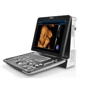 Mindray Z50 Portable Color Doppler - Image 3