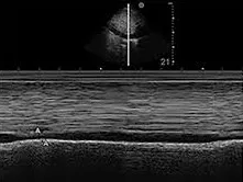 Peristalsis Assessment